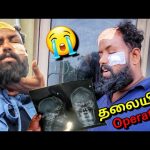 விபத்தில் சிக்கி உயிர் தப்பினேன்!😭 I Met Accident | Alasteen Rock | Jaffna Tamil Vlogs