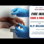 🔴Live | Fire Injury – Care and First Aid  | Hello Ungaludan | 29 – 10 – 2024