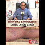 Varicose Veins Treatment | நலம் தரும் மருத்துவம் | Sun News